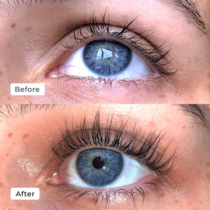 Starion™ Lash Serum