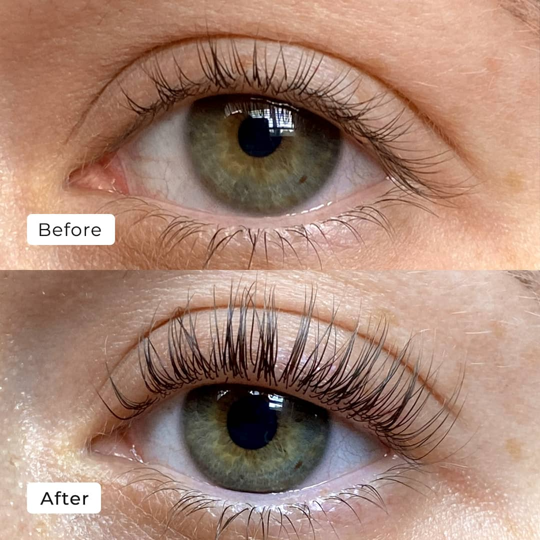 Starion™ Lash Serum